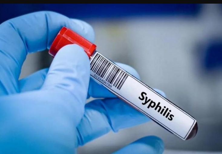 Preocupación por el brote de sífilis en Argentina: cifras récord en jóvenes y adultos
